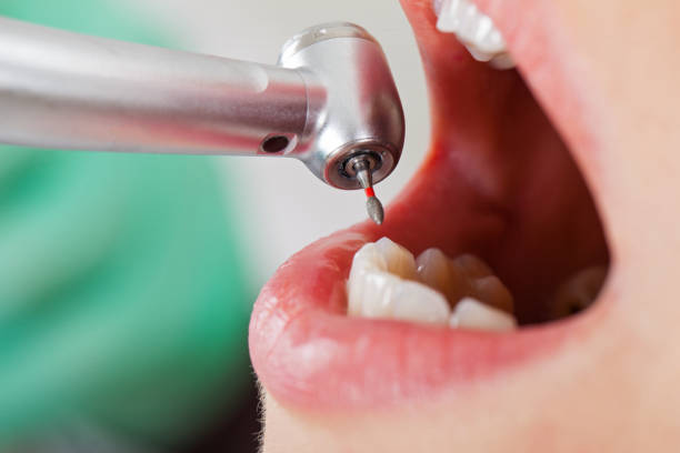 Best Walk-In Emergency Dental Services in Warrenton, VA